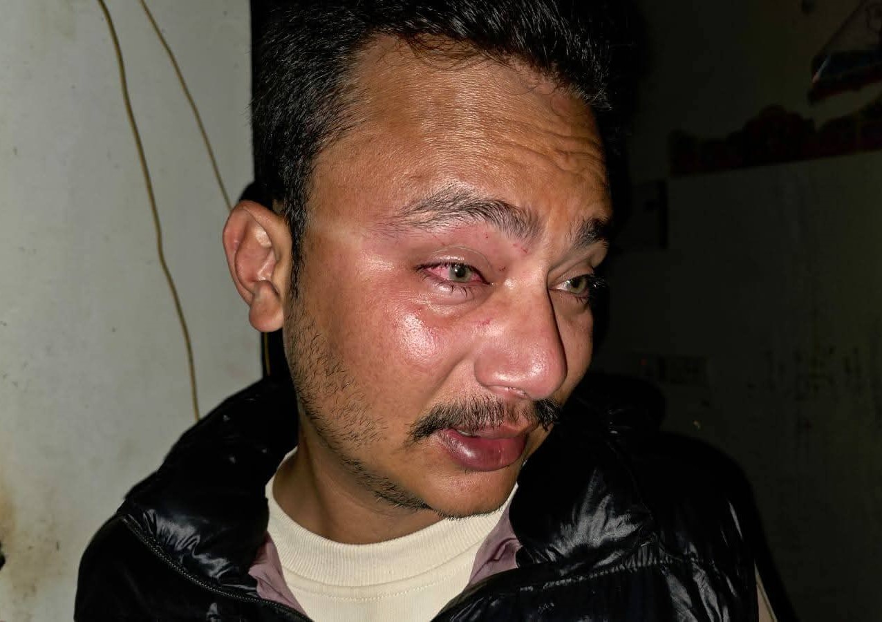 Reporter attacked in Kailali