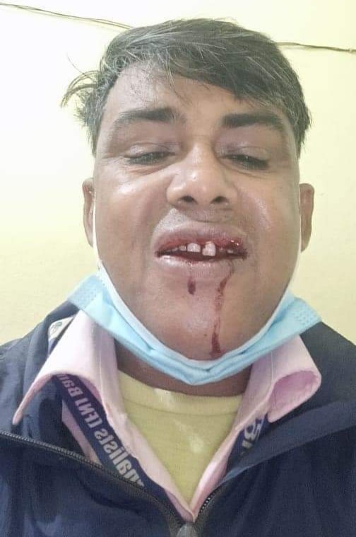 Senior journalist injured in attack  