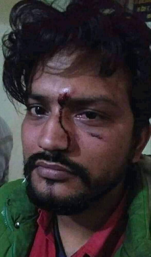 Ruling party member Bishwakarma attacks journalist by mobilizing goons