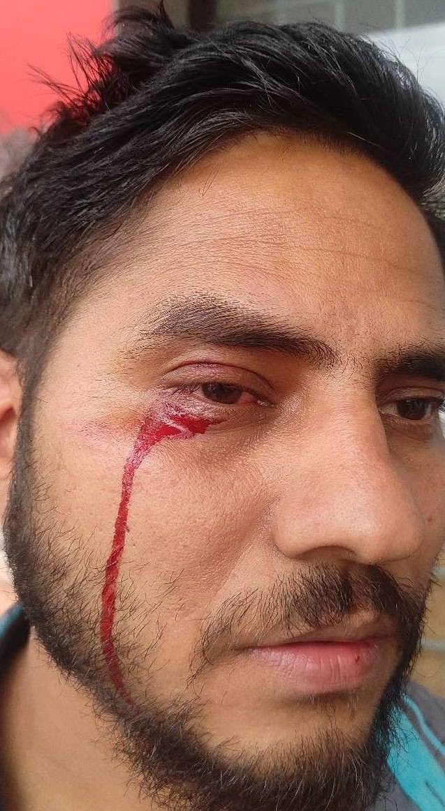 Journalist attacked while covering event in Kathmandu