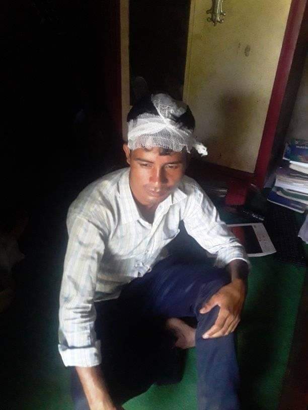 Correspondent Thapa attacked brutally