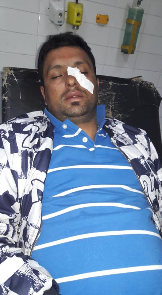 Reporter Kafle injured in brutal attack; FF demands rigorous punishment to assaulters